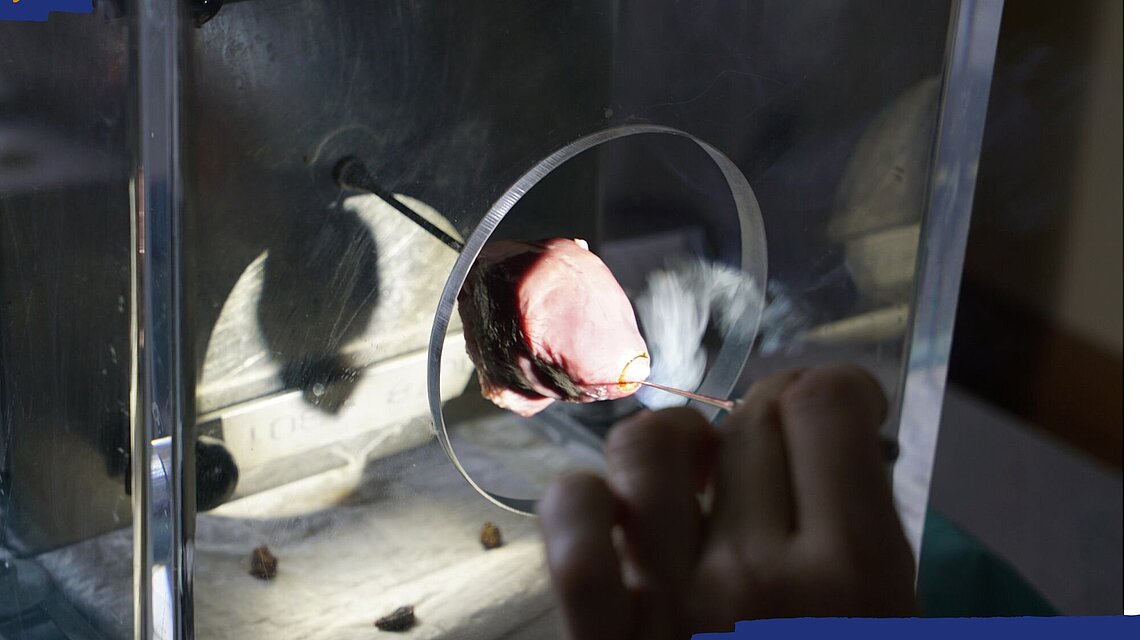 Schulungen für Kolposkopie: Gebärmutterhalskrebs